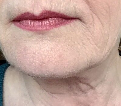 Product Review: Getting Rid of the Retin-A Flakes