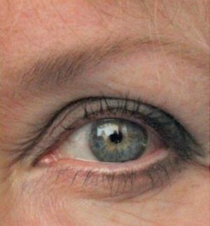 CLOSE UP OF EYE