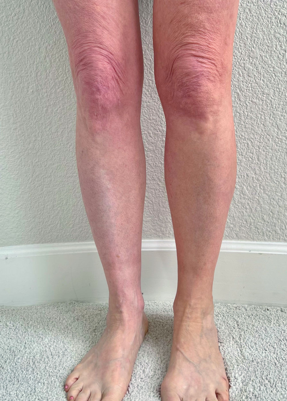 Best Self Tanner for Mature Skin